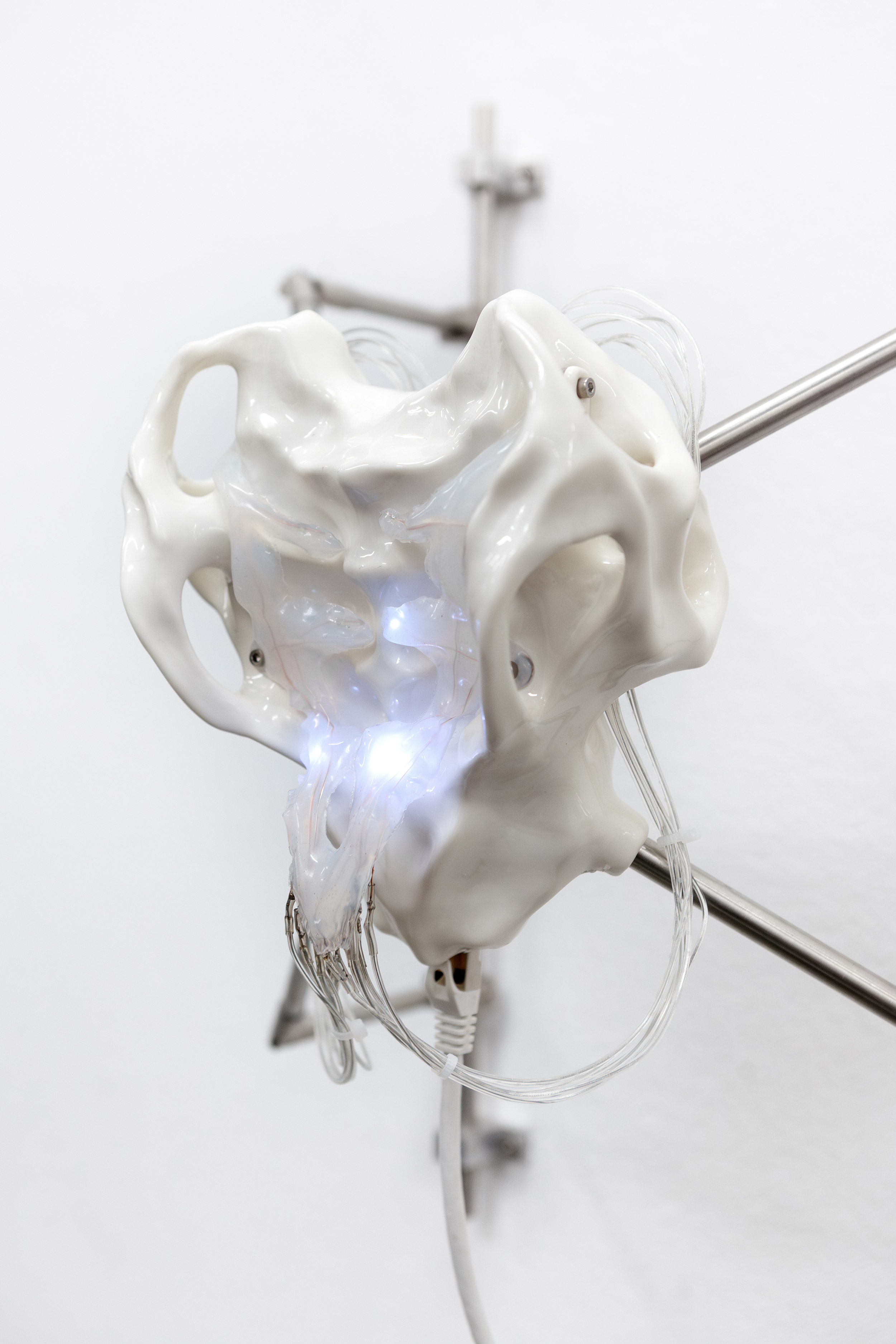 It hurts when IP installation view