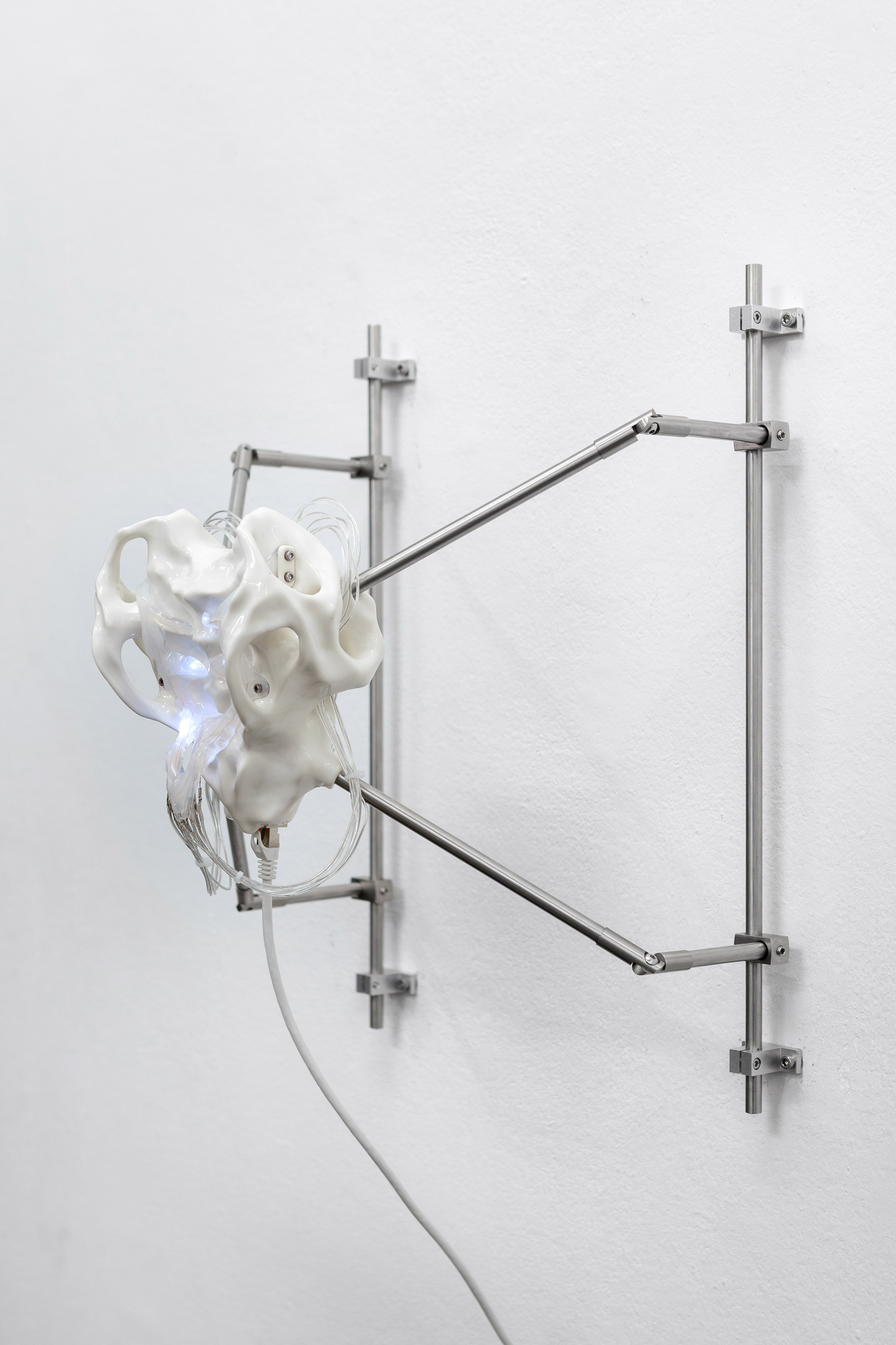 It hurts when IP installation view